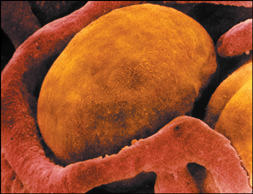 New Type Of Brown Fat Cells Could Treat Obesity Effectively