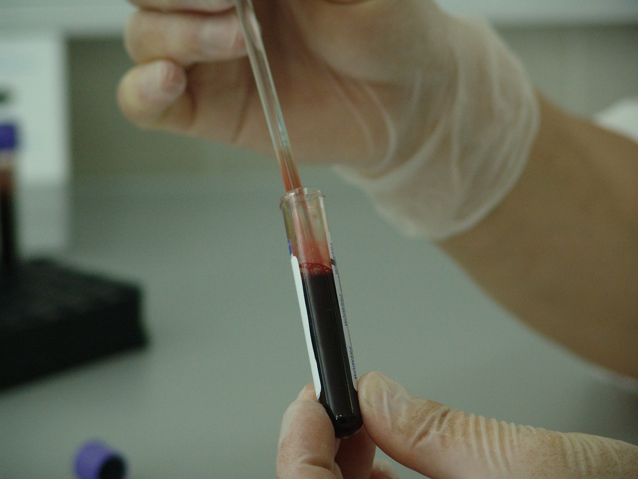 Marker-Free Isolation of Circulating Tumor Cells from Blood of Patients