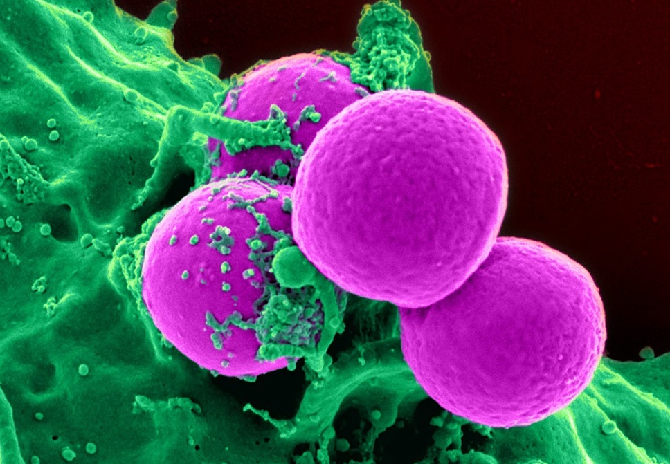 The Evasive Agents: How Drug-delivering Nanoparticles Avoid the Immune System