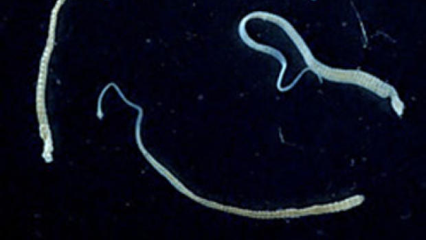 CDC Report: Columbian Man Diagnosed with Cancer of Tapeworm Origin