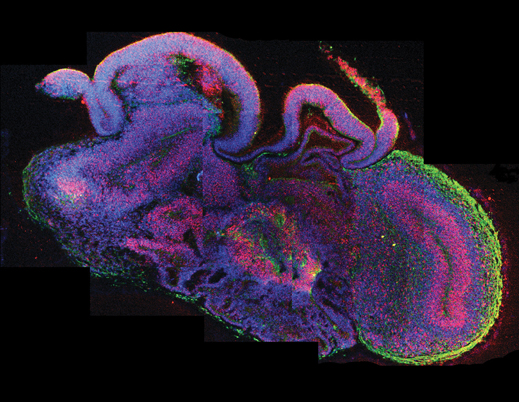 ‘Mini-brains’ in a Dish: Unlocking the Mysteries of Human Brain Development