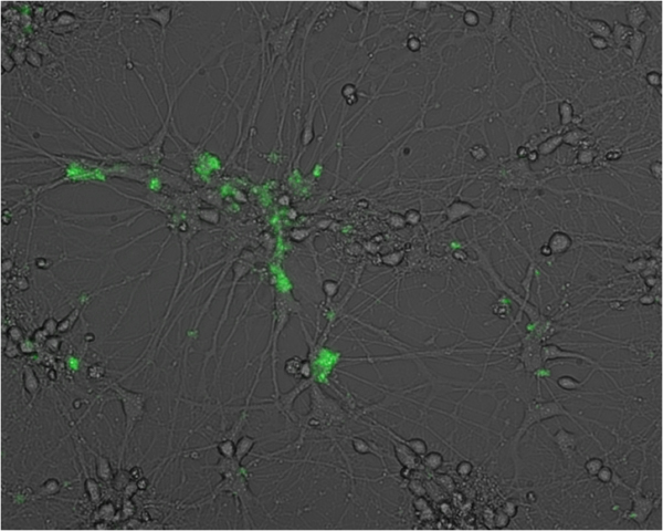 Penn State Research: Herpes Virus Can Infect Human Neuronal Cells
