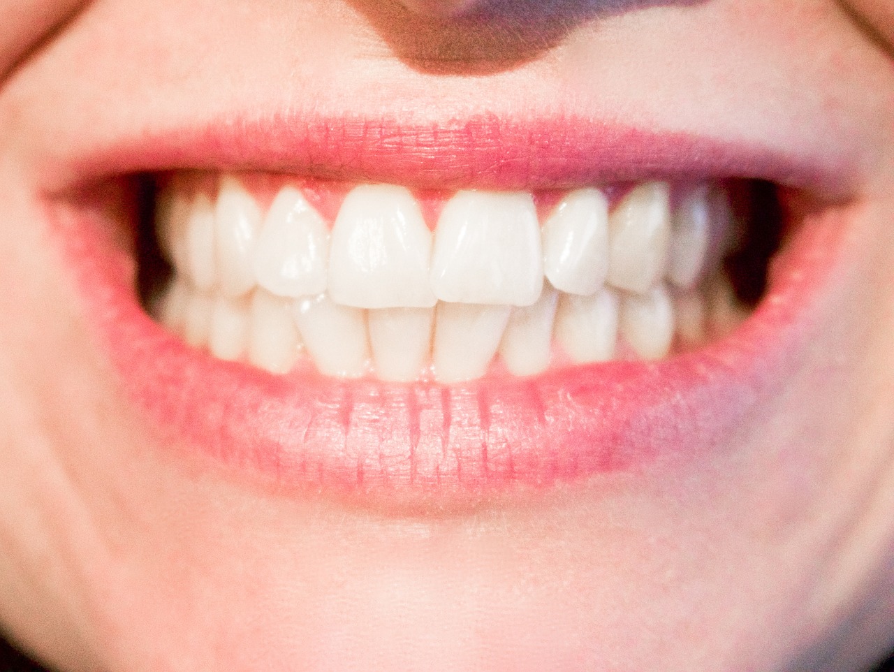 A review of dental stem cells – where are we now in regards to clinical trials?