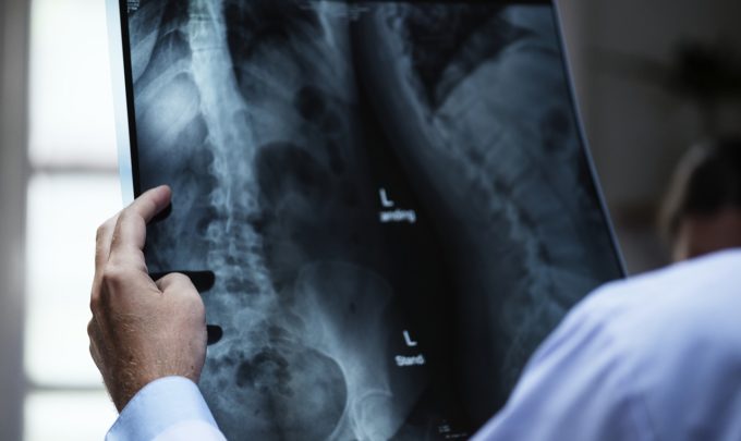The place of AI in radiology today