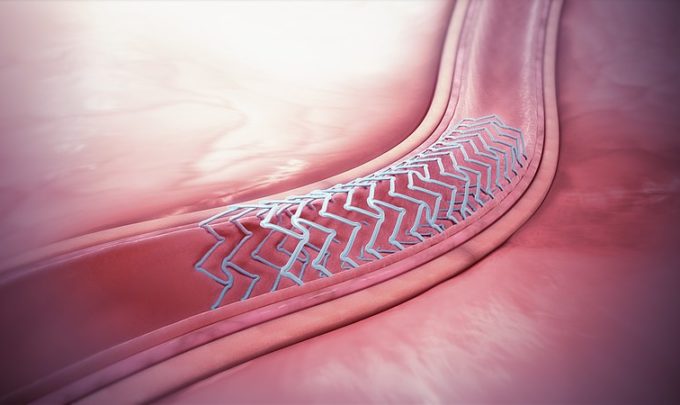 Designed to dissolve: Bioresorbable medical devices