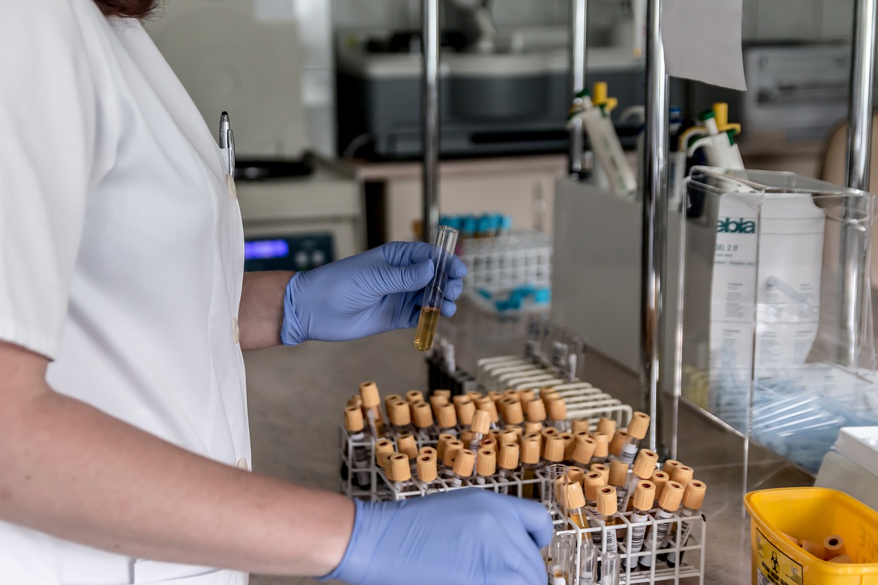Roche’s Elecsys IL-6 test receives FDA Emergency Use Authorization