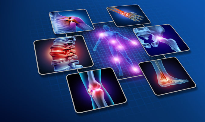 Novel anti-inflammatory drugs: Viable strategies to end the dry spell