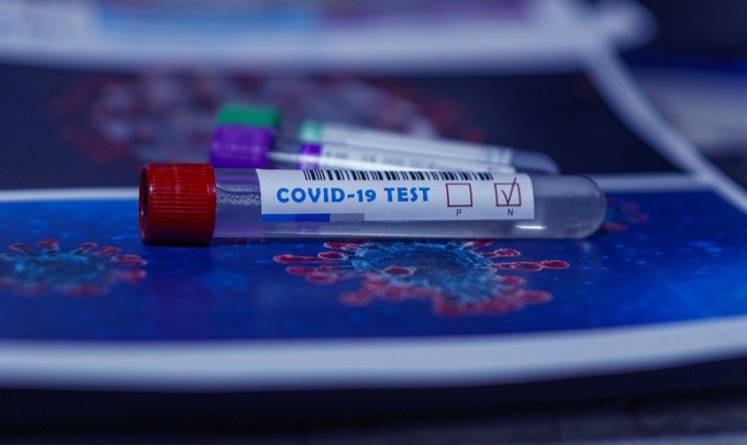Client testimonial: A user-friendly COVID-19 workplace testing solution