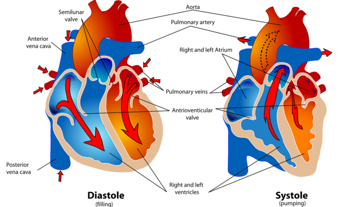 Aortic Stenosis