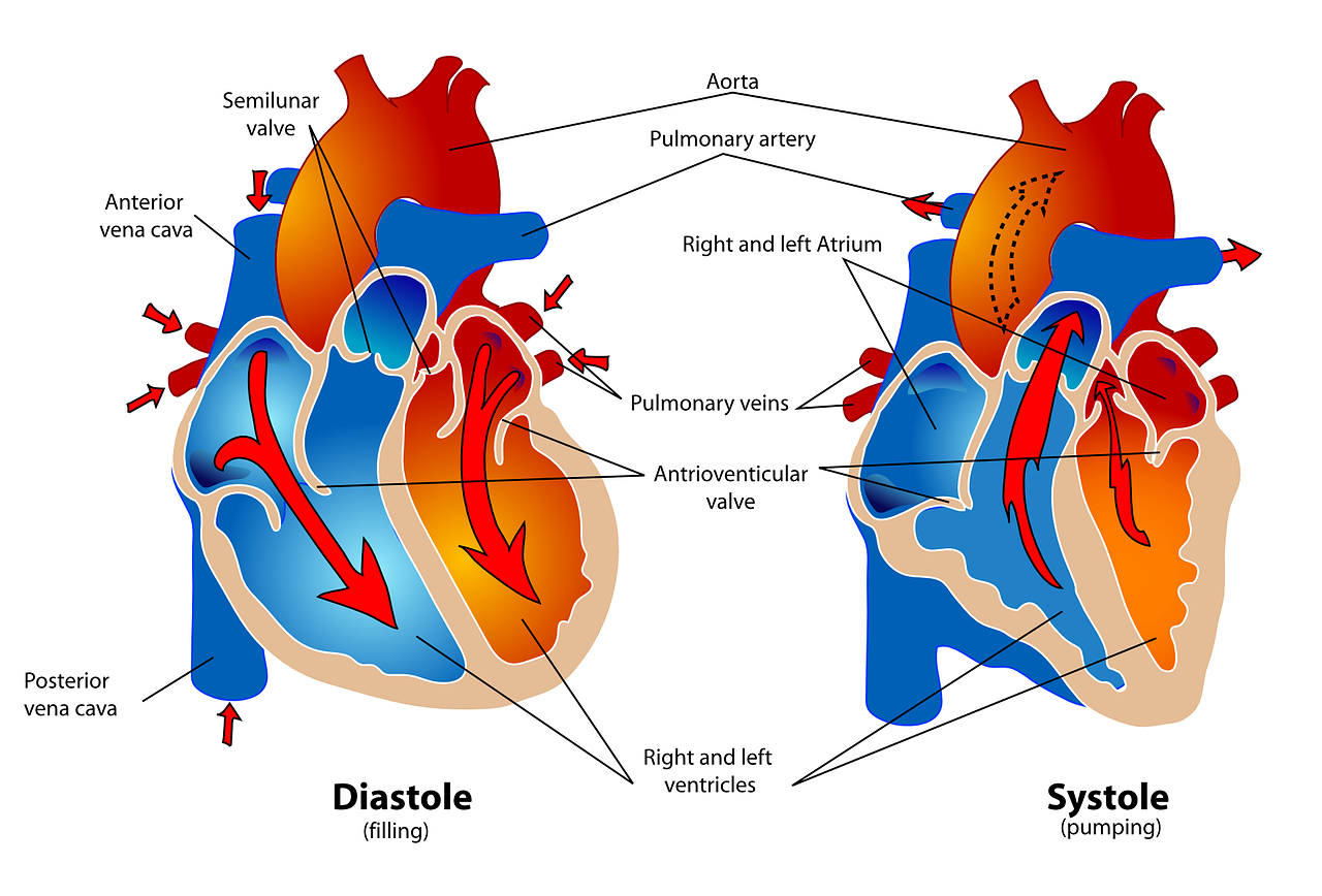 Aortic Stenosis